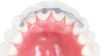 Picture of Lingual Retainers 3To 3 36 mm Upper Size - PK/2