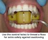 use a floss with orthodontic Tongue block or dental tongue shield